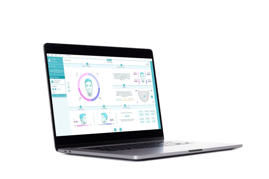 myowsise emg system software